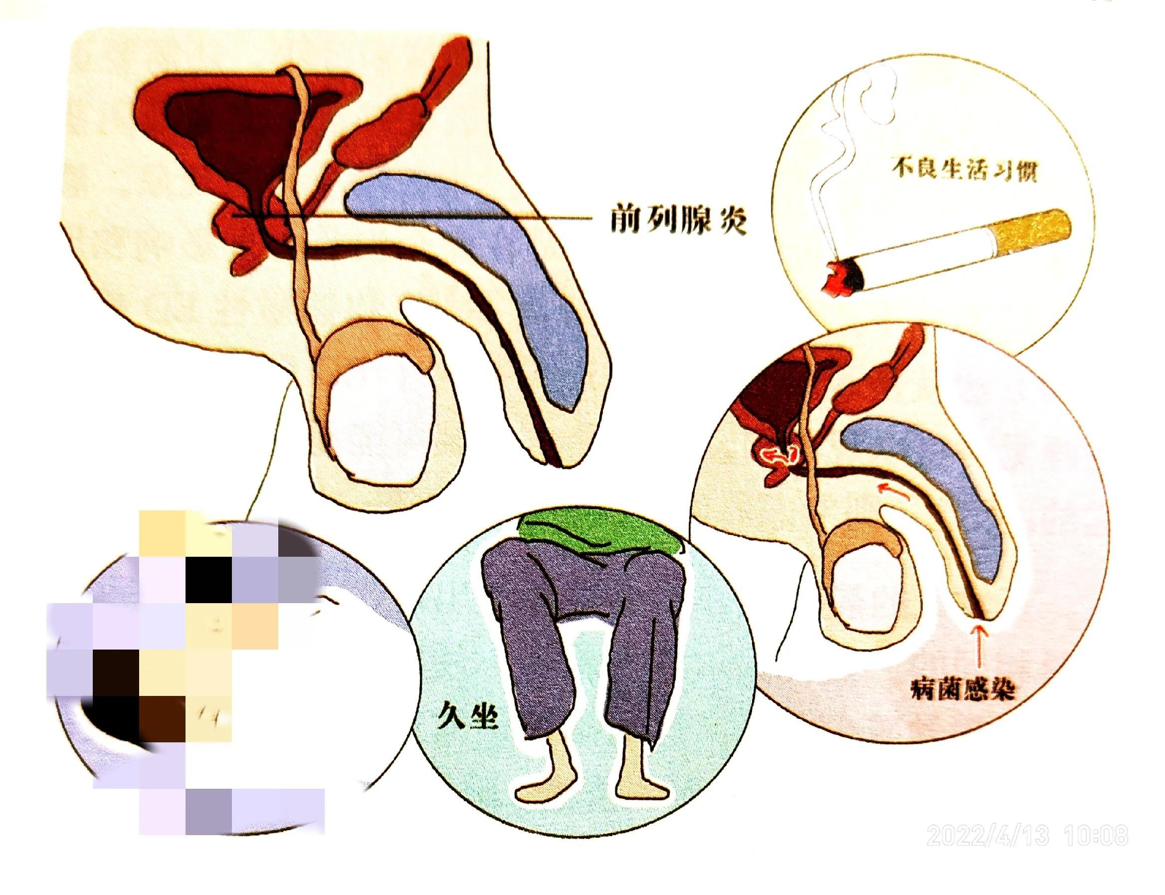 最新疾病圖譜揭示當(dāng)代健康挑戰(zhàn)
